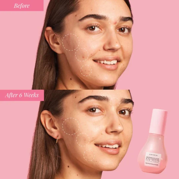 Glow Recipe  Watermelon Glow Niacinamide Dew Drops Serum - Imagen 3